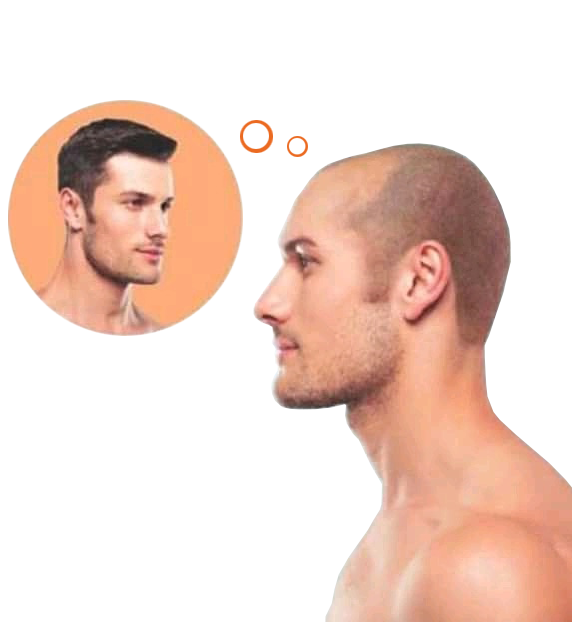what is non-surgical hair replacement method ?